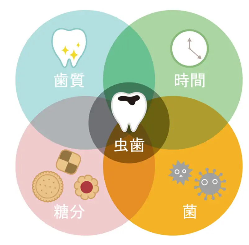 虫歯の原因の歯質、時間、糖分、菌
