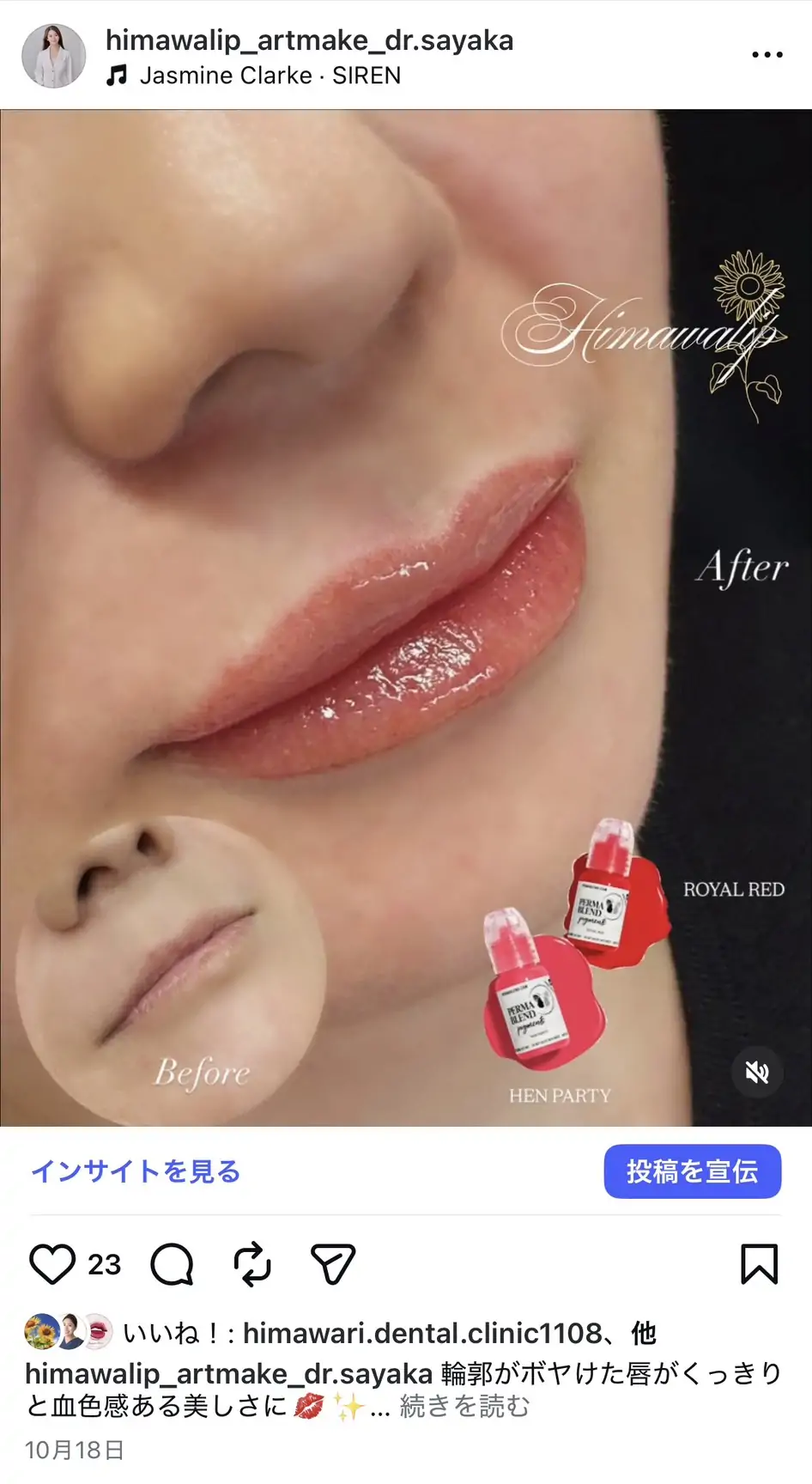 高濃度ビタミンC点滴の画像